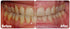 ProBiora Oral-Care Chewable Probiotic Tablets, 60 Count for Healthier Teeth and Gums