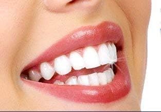 Miracle Brite Smile with Food Grade Hydrogen Peroxide and Essential Oils - Teeth whitening, Breath freshening, Removing