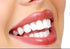 Miracle Brite Smile with Food Grade Hydrogen Peroxide and Essential Oils - Teeth whitening, Breath freshening, Removing
