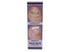 VIT20 V20 20 Vite Antifungal Cream Fungus Killer Hand and Feet Nail Treatment