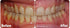 ProBiora Oral-Care Chewable Probiotic Tablets for Women & Men, Healthier Teeth & Gums, 30 Count