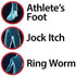 Globe Miconazole Nitrate 2% Antifungal Cream, 1 oz, Cures Most Athletes Foot, Jock Itch, Ringworm