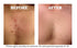 Organic Sea Salt Spray for Face, Body, and Hair, Acne and Rosacea Toner