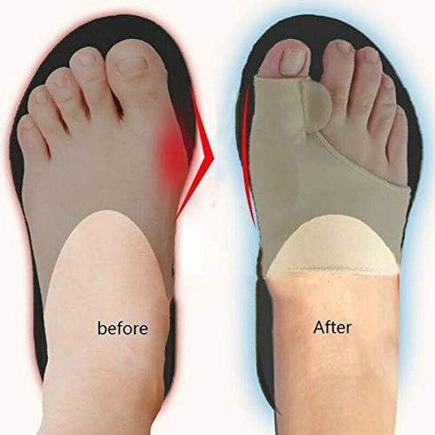 Valgus Bunion Corrector Bunion Splint for Crooked Toes Alignment Pain Relief, Orthotics Feet Bone Thumb Adjuster Sock