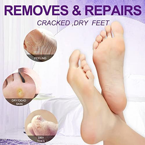 Pedicure Kit Foot Soak Set: Bubble Salt, Sugar Scrub, Massage Mask, Lotion, 4 Step Foot Spa Kit for Dry Feet (3 Set
