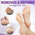 Pedicure Kit Foot Soak Set: Bubble Salt, Sugar Scrub, Massage Mask, Lotion, 4 Step Foot Spa Kit for Dry Feet (3 Set