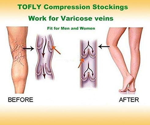 Knee High Compression Stockings - Firm Support 20-30 mmHg Opaque Maternity Socks, Open-Toe, 1 Pair Blue 3XL