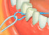 BridgeAid Threaders, 10 Packs of 10, 100 Threaders