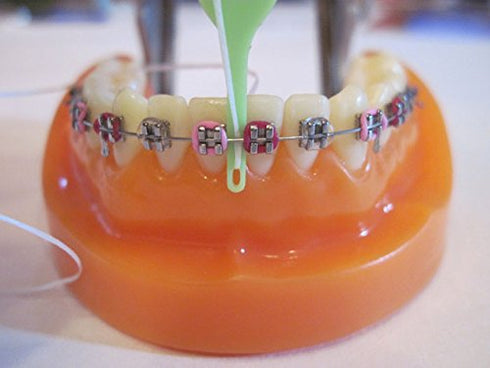 Reusable Orthodontic Flossers in 5 Mixed Colors