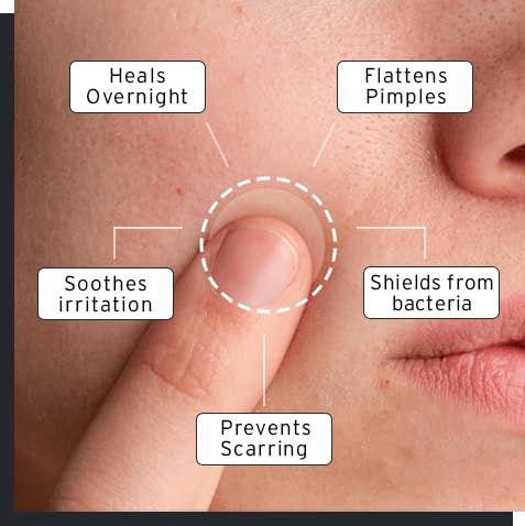 No BS Intensive Overnight Pimple Patches, Fast-Acting Acne Spot Treatment, 1 BOX of 36ct