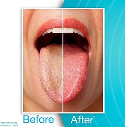 DrTung's Stainless Steel Tongue Cleaner & Smart Floss Bundle - Tongue Cleaner for Adults, Kids, Natural Floss, Travel