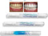 White Teeth Global 2 1 Teeth Whitening Kit Including Whitening Pens and Remineralization Pen.