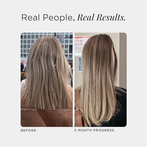 JSHealth Vitamins Hair and Energy Formula Hair Growth Vitamins | Hair Vitamins for Women and Men with Zinc and Iodine -