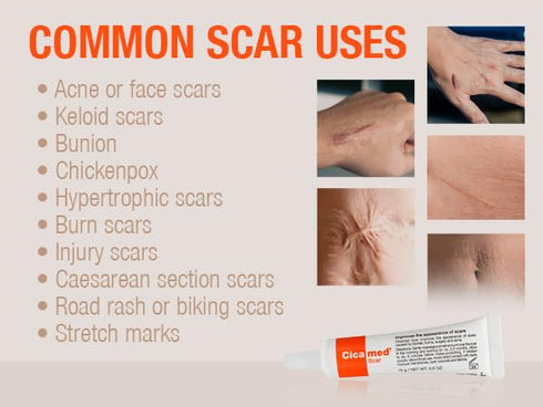 Silicone Scar Gel - Advanced Cream for Surgical Scars, C-Section, Burns, Keloids, Acne Marks - 0.5 oz (15g) - Works