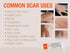 Silicone Scar Gel - Advanced Cream for Surgical Scars, C-Section, Burns, Keloids, Acne Marks - 0.5 oz (15g) - Works