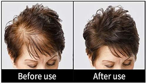 Volumizing Hair Fibers with Real Keratin for Thinning Hair, 60 Days+ Supply, Dermatologist Tested, Black
