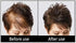 Volumizing Hair Fibers with Real Keratin for Thinning Hair, 60 Days+ Supply, Dermatologist Tested, Black
