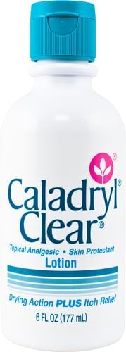 Caladryl Lotion for Dry Skin, Topical Analgesic for Itch Relief, 6 Fl Oz