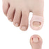 Ingrown Toenail Corrector Sleeves - 4 Pairs Elastic Silicone Tool for Thick Paronychia Treatment