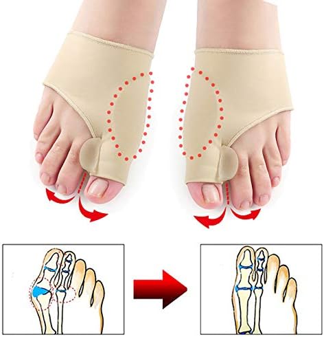 Valgus Bunion Corrector Bunion Splint for Crooked Toes Alignment Pain Relief, Orthotics Feet Bone Thumb Adjuster Sock
