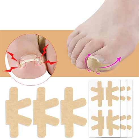 Ingrown Toenail Correction Stickers, 16 Pcs Thick Paronychia Corrector Patches for Nail Healing Care