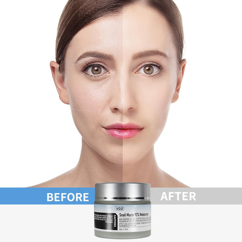 VGO Snail Mucin 92% Moisturizer - Daily Hydrating Repair Face Gel Cream for Dry & Sensitive Skin, 50g / 1.76oz