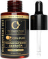 Frankincense Essential Oil for Body Comfort - 100% Natural Organic Oil for Skin, Face & Diffuser