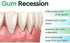 3PCS DentiZen Gum Regrowth Drops, Natural Gum Liquid Drops for Gum Relief and Mouthwash