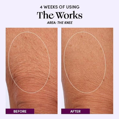 Womaness The Works All-Over Toning Body Cream – Hydrating & Smoothing Firming Lotion with Niacinamide & Hyaluronic Acid