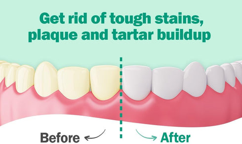 Protech Denture Cleaner 7g (3-Month Supply) - Denture Cleanser Foils for Retainers, Nightguards, Mouthguards, and
