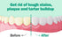 Protech Denture Cleaner 7g (3-Month Supply) - Denture Cleanser Foils for Retainers, Nightguards, Mouthguards, and