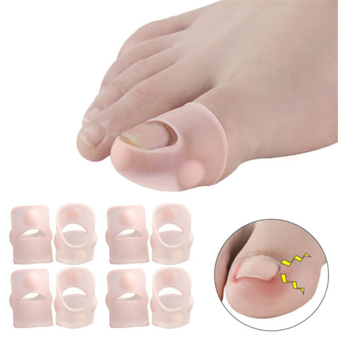 Ingrown Toenail Corrector Sleeves - 4 Pairs Elastic Silicone Tool for Thick Paronychia Treatment