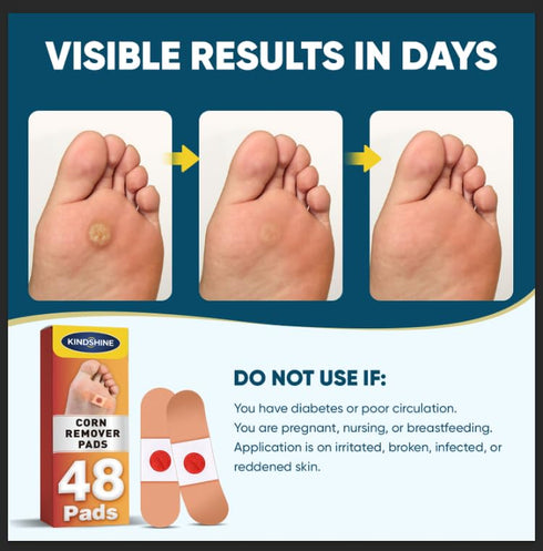 kindshine 96P 40% Corn Remover Pads for Feet and Toes, Extra Strength Salicylic Acid Medicated Patches, Effective