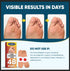 kindshine 96P 40% Corn Remover Pads for Feet and Toes, Extra Strength Salicylic Acid Medicated Patches, Effective