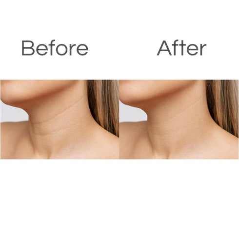 Neck and Chest Wrinkle Pads, Anti-Aging Skin Firming Lift for Fine Lines & Sagging, Reusable Silicone Pads