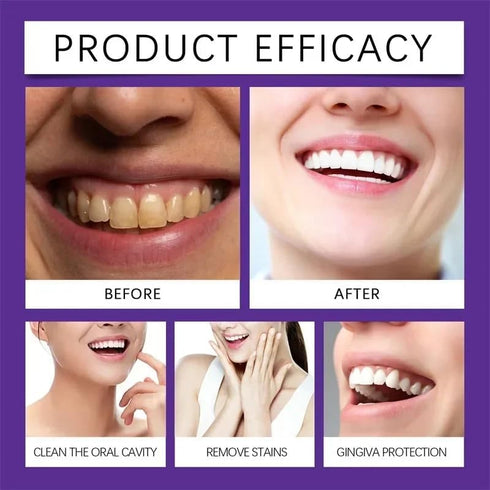 WUBLSYAN (50G) Teeth Restoration Mineral Powder, Purple Dental Restoration Mineral Powder, Effective in Strengthening