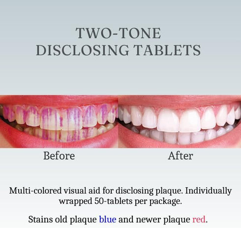 Dental Disclosing Tablets for Kids and Adults, Individually Wrapped, Safe & Effective Two-Tone Cleaning Tablets, 50