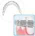 Comfort Cover for Braces, Lip Protector Mouth Guard, Teeth Shield Bumper for Brackets and Aligners