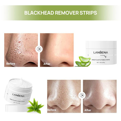 LANBENA Blackhead Remover Peel Off Mask - Remove Blackheads from Face & Nose, 1.05oz