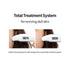 SECRETKEY Starting Treatment Essence, 95% Galactomyces Ferment Filtrate, Natural Ingredients, 5.24 fl. Oz.