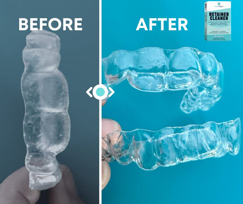 Retainer Cleaner, Denture Cleaner (120 Tablets) Brightens and Freshens Clear Aligners, Retainers, Dental Appliances