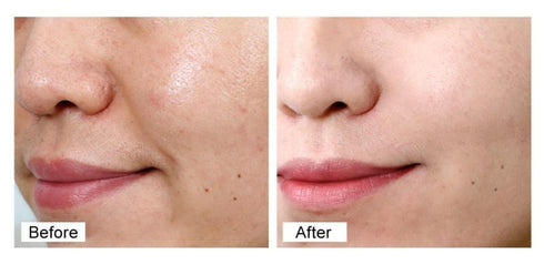 Retinol Cream for Face - Day and Night Moisturizer Face Cream with Vitamin E, Hyaluronic Acid and Collagen for Skin Tightening, Anti Wrinkles - Anti Aging Face Moisturizer for Women and Men, 1.7 Fl OZ