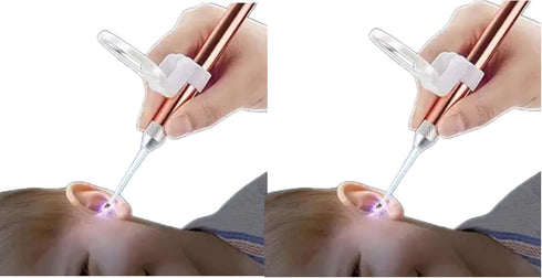 SelHeng 2Pcs Rose Gold Ear Wax Removal Kit,Stainless Steel Ear Wax Remover with