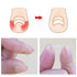 Ingrown Toenail Corrector Strips Brace - 10pcs/bottle - Straightener Clip for Thick Toenails