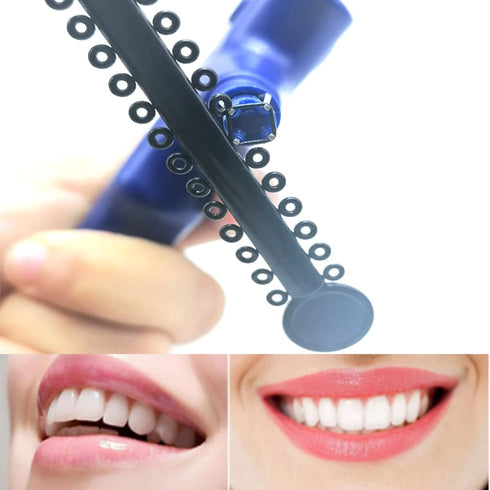 1040 Pcs Black Braces Rubber Bands, Orthodontic Ligature Ties O-Rings Elastic Bands for Braces