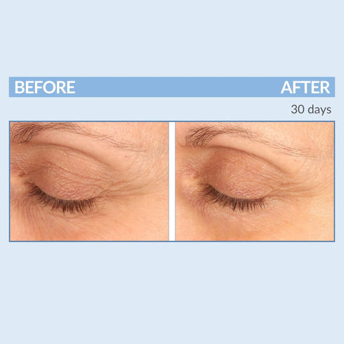Serious Skincare Eyetality Morning Total Eye Care Cream - 0.5 oz, for Lines, Wrinkles, Puffiness & Dark Circles