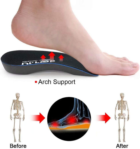 Dr. Foot's 3/4 Length Orthotic Inserts, Self-Adhesive Half Shoe Insoles for Flat Feet, Plantar Fasciitis, Heel Spurs