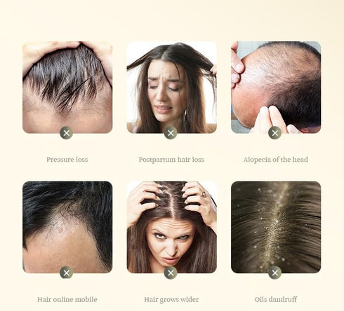 2 Box Ginger Plant Extract Anti-Hair Loss Shampoo - Ginger Shampoo for Hair Growth, 400g