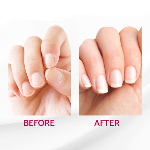 IBD Reconstrux Nail Repair Treatment - Nail Strengthener for Weak & Damaged Nails, 0.125 fl oz, 2 Pack
