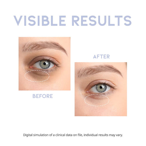 Korean Eye Serum for Under Eye, Hydrating, Anti-Aging, Firming, Dark Circle Treatment with Hyaluronic Acid, Vitamin C,